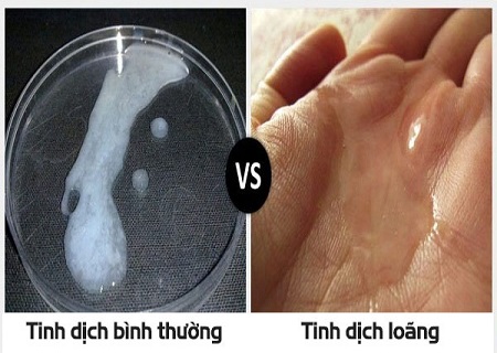 Cách nhận biết tinh trùng mạnh hay yếu